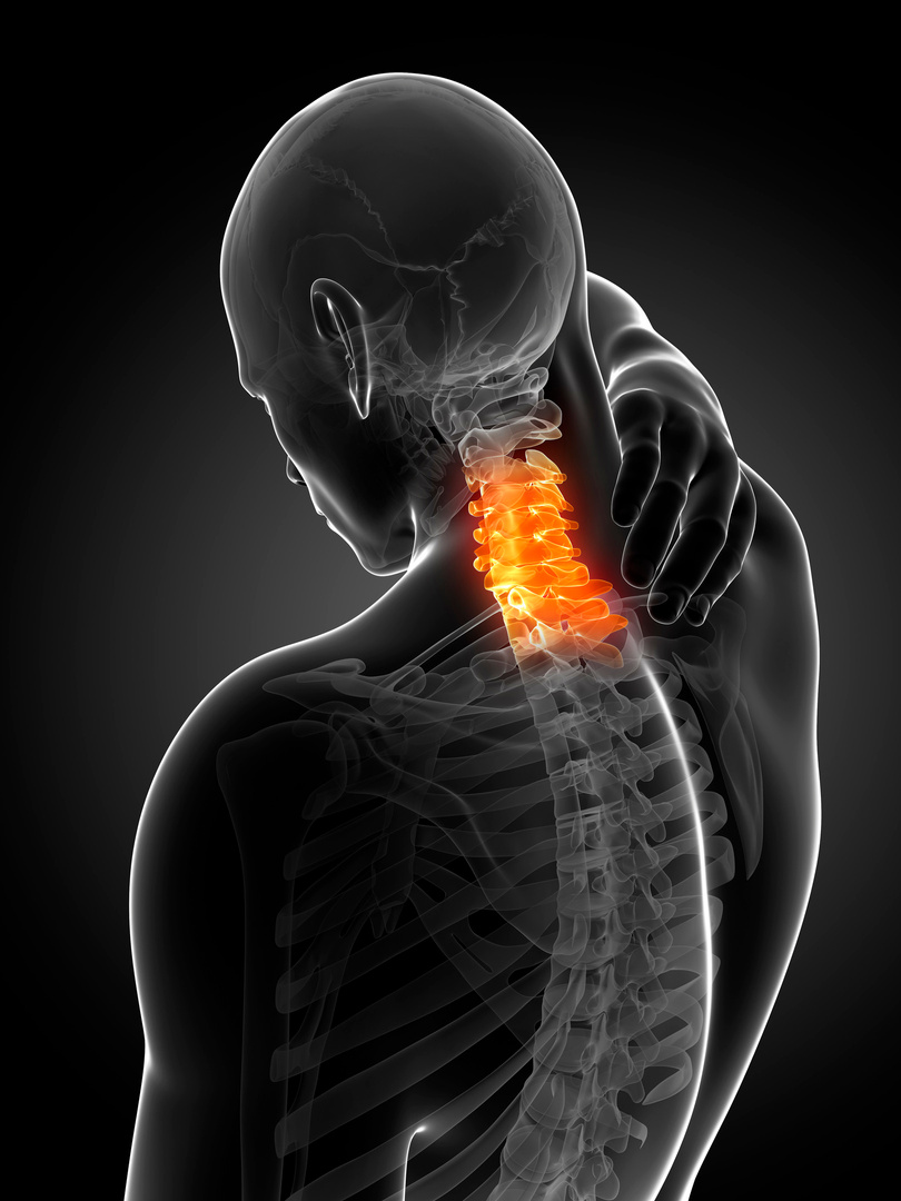 "Human neck pain